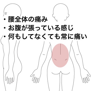 腰をうまく反ることができない ピキッ とした腰の痛み 埼玉県朝霞市 耳 腰 肩こり専門の鍼灸院 國定鍼灸院